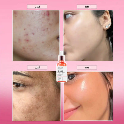 سيروم 5 في 1 لتفتيح البشرة والتخلص من التجاعيد و البقع الداكنة